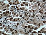 METTL3 Antibody in Immunohistochemistry (Paraffin) (IHC (P))