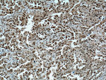 METTL3 Antibody in Immunohistochemistry (Paraffin) (IHC (P))