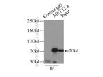 METTL3 Antibody in Immunoprecipitation (IP)
