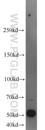 SUOX Antibody in Western Blot (WB)