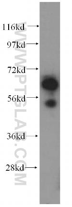 SUOX Antibody in Western Blot (WB)