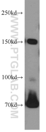 VPS8 Antibody in Western Blot (WB)