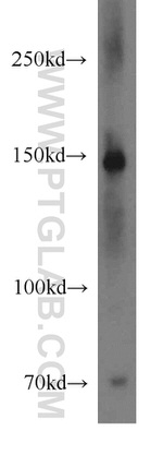 VPS8 Antibody in Western Blot (WB)