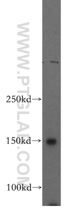 VPS8 Antibody in Western Blot (WB)