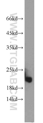 COQ7 Antibody in Western Blot (WB)