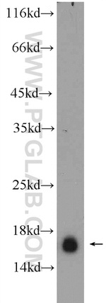 RPS19 Antibody in Western Blot (WB)