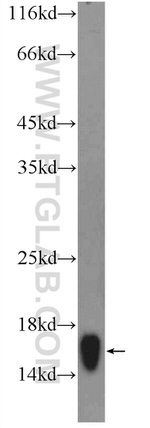 RPS19 Antibody in Western Blot (WB)