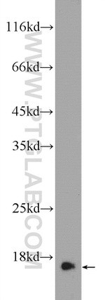 RPS19 Antibody in Western Blot (WB)