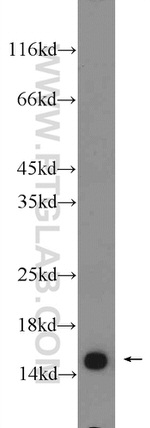 RPS19 Antibody in Western Blot (WB)