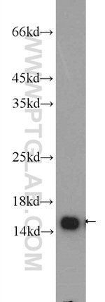 RPS19 Antibody in Western Blot (WB)