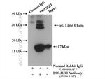 POLR2H Antibody in Immunoprecipitation (IP)