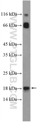 POLR2H Antibody in Western Blot (WB)