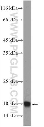 POLR2H Antibody in Western Blot (WB)