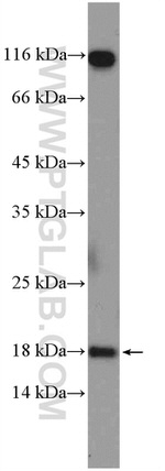 POLR2H Antibody in Western Blot (WB)