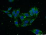 SEC61B Antibody in Immunocytochemistry (ICC/IF)