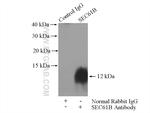 SEC61B Antibody in Immunoprecipitation (IP)