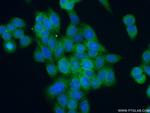 ANTXR1 Antibody in Immunocytochemistry (ICC/IF)