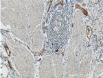 ANTXR1 Antibody in Immunohistochemistry (Paraffin) (IHC (P))