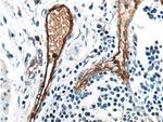 ANTXR1 Antibody in Immunohistochemistry (Paraffin) (IHC (P))