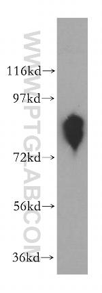 ANTXR1 Antibody in Western Blot (WB)