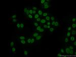 SCML1 Antibody in Immunocytochemistry (ICC/IF)