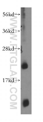 SCML1 Antibody in Western Blot (WB)