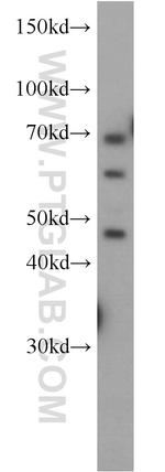 NAGA Antibody in Western Blot (WB)