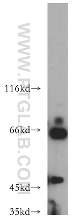 NAGA Antibody in Western Blot (WB)