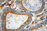 ATP6V1B2 Antibody in Immunohistochemistry (Paraffin) (IHC (P))