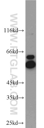 ATP6V1B2 Antibody in Western Blot (WB)