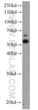 ATP6V1B2 Antibody in Western Blot (WB)