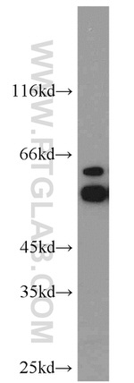 ATP6V1B2 Antibody in Western Blot (WB)