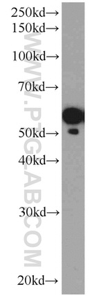 ATP6V1B2 Antibody in Western Blot (WB)