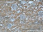 INPP5K Antibody in Immunohistochemistry (Paraffin) (IHC (P))