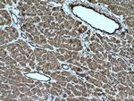 TGM2 Antibody in Immunohistochemistry (Paraffin) (IHC (P))