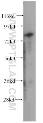 TGM2 Antibody in Western Blot (WB)