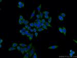 TNIP1 Antibody in Immunocytochemistry (ICC/IF)