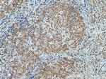 TNIP1 Antibody in Immunohistochemistry (Paraffin) (IHC (P))