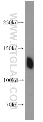 Cadherin-16 Antibody in Western Blot (WB)
