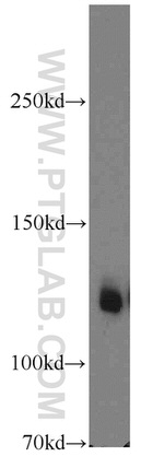 Cadherin-16 Antibody in Western Blot (WB)