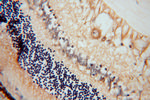 AIPL1 Antibody in Immunohistochemistry (Paraffin) (IHC (P))