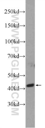 AIPL1 Antibody in Western Blot (WB)