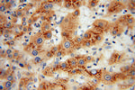 PHKG2 Antibody in Immunohistochemistry (Paraffin) (IHC (P))