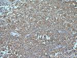 PHKG2 Antibody in Immunohistochemistry (Paraffin) (IHC (P))