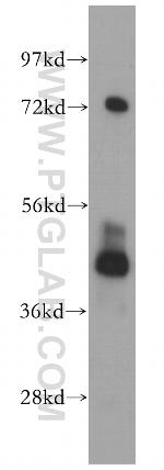 PHKG2 Antibody in Western Blot (WB)