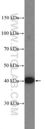 PHKG2 Antibody in Western Blot (WB)