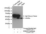 PHKG2 Antibody in Western Blot (WB)