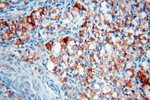 NSDHL Antibody in Immunohistochemistry (Paraffin) (IHC (P))