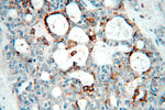 NSDHL Antibody in Immunohistochemistry (Paraffin) (IHC (P))