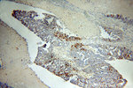 NSDHL Antibody in Immunohistochemistry (Paraffin) (IHC (P))